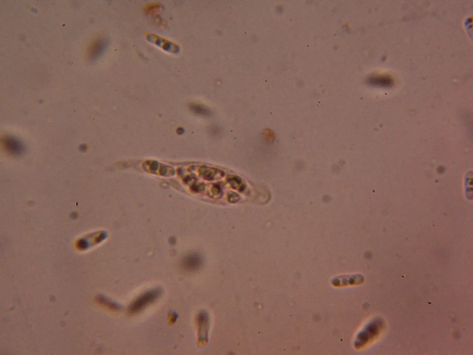 Microscopía de Nitschkia grevillii - 12 - Asca 1